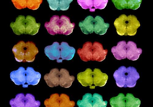 Le cerveau en couleur