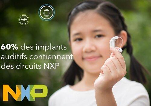 NXP,  l'innovation au service de la santé, 60% des implants auditifs contiennent des circuits NXP