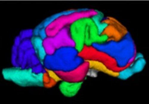 L'imagerie par résonance magnétique (IRM) permet d'identifier les différentes aires du cerveau.