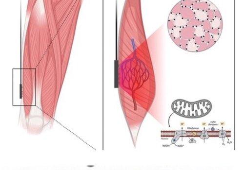 vue du muscle selon l'intensité