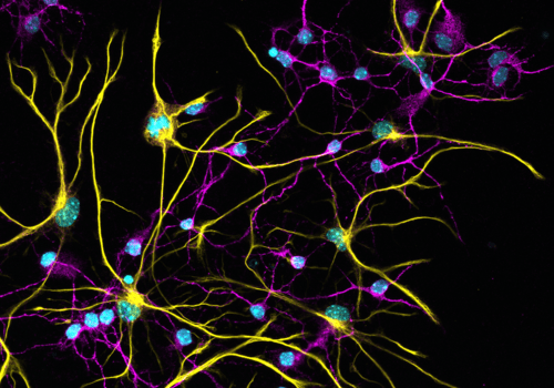 Immunofluorescence sur neurones de souris en culture