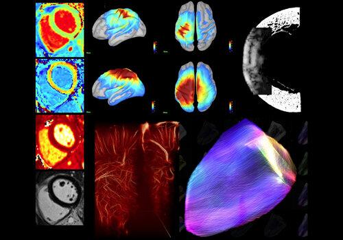 Ultrasons, IRM, EEG, MEG ... autant de technologies en pleine évolution