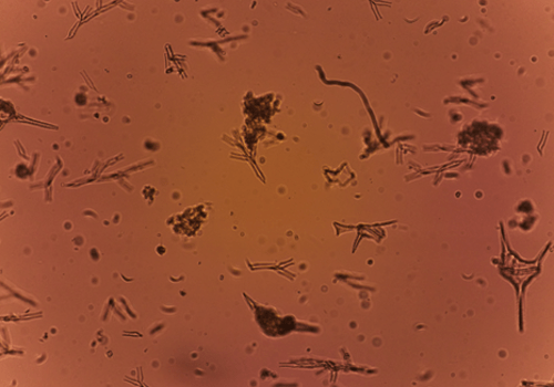 Image de phytoplanctons vus au Planktoscope