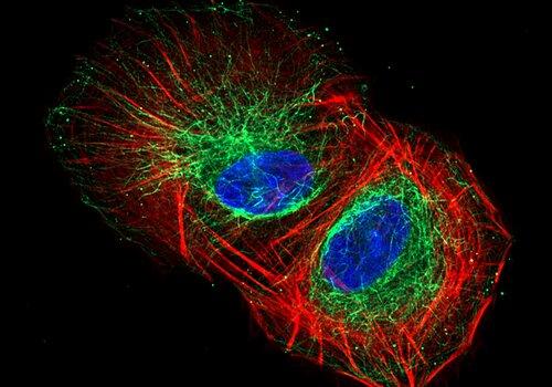 Marquages immnuo fluorescent sur un modèle cellulaire d’ostéosarcome (cancer des os). Marquage des fibres de stress d’actine en rouge, des microtubules en vert et des noyaux en bleu.