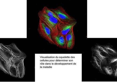 Visualisation du squelette des cellules pour déterminer son rôle dans le développement de la maladie.