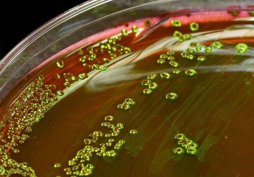 Gros plan de colonies de la bactérie Escherichia coli cultivée sur gélose EMB (Eosin Methylene Blue)