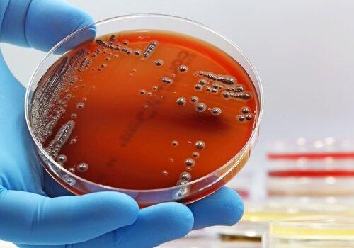 Colonies de bactéries qui se développent sur une boîte de Pétri