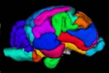 L'imagerie par résonance magnétique (IRM) permet d'identifier les différentes aires du cerveau.