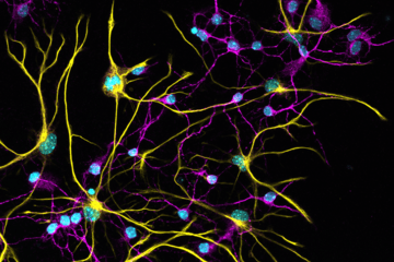 Immunofluorescence sur neurones de souris en culture