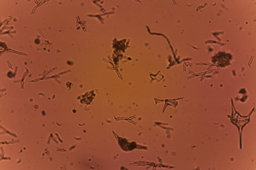 Image de phytoplanctons vus au Planktoscope