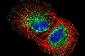 Marquages immnuo fluorescent sur un modèle cellulaire d’ostéosarcome (cancer des os). Marquage des fibres de stress d’actine en rouge, des microtubules en vert et des noyaux en bleu.