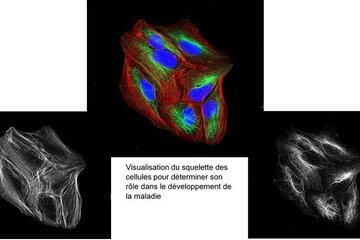 Visualisation du squelette des cellules pour déterminer son rôle dans le développement de la maladie.